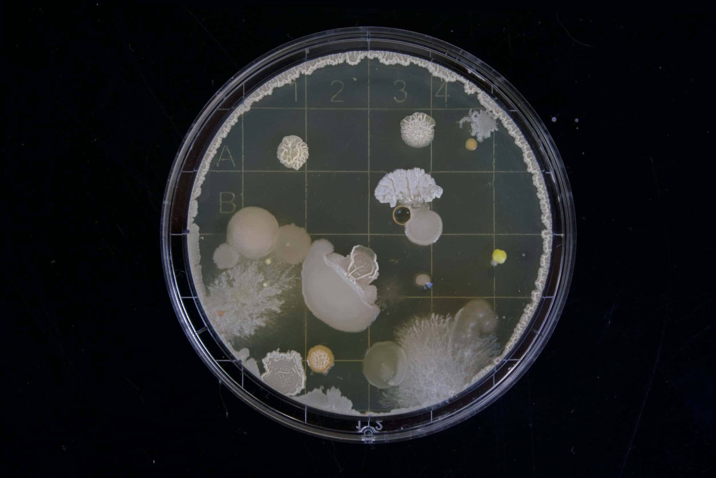Petri dish with diverse bacterial colonies